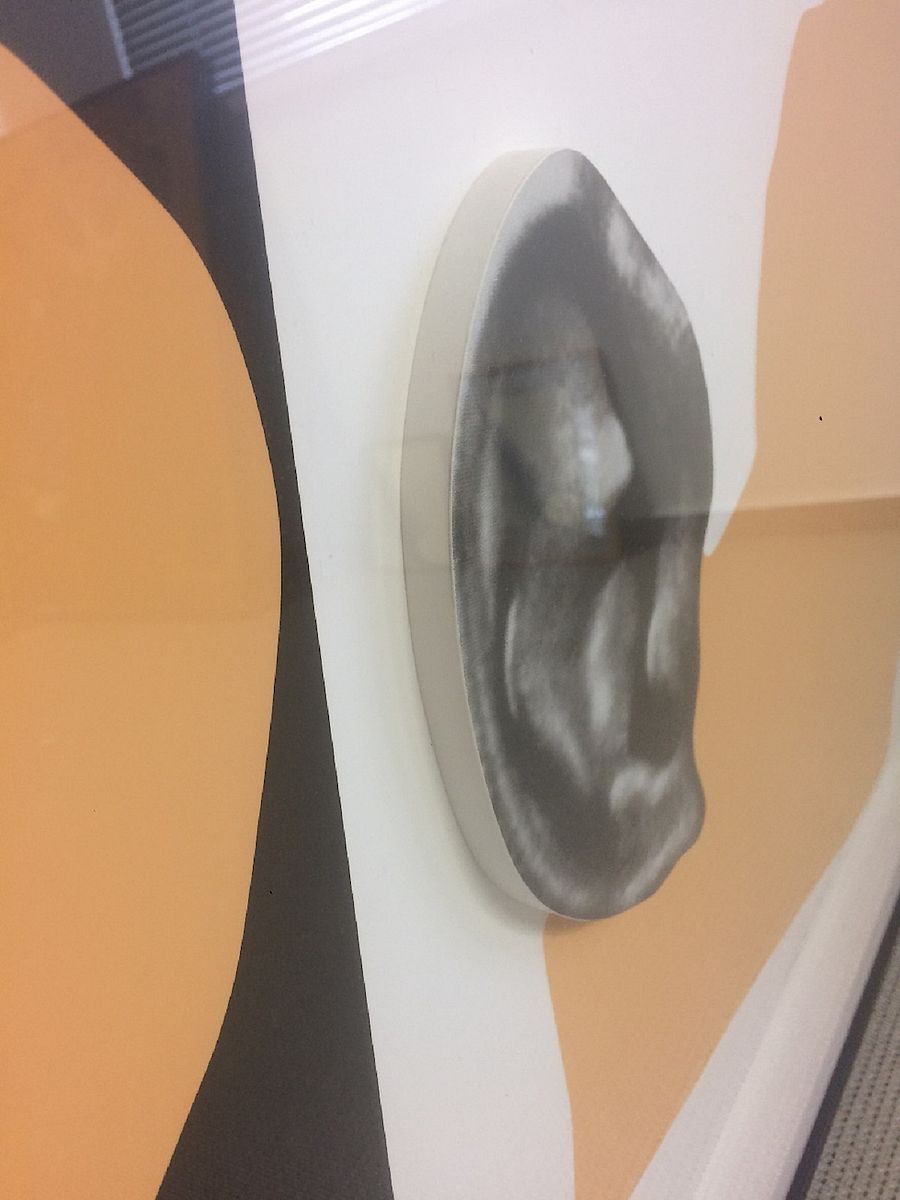 Korff Stiftung - John Baldessari - Grafiken - Noses and ears